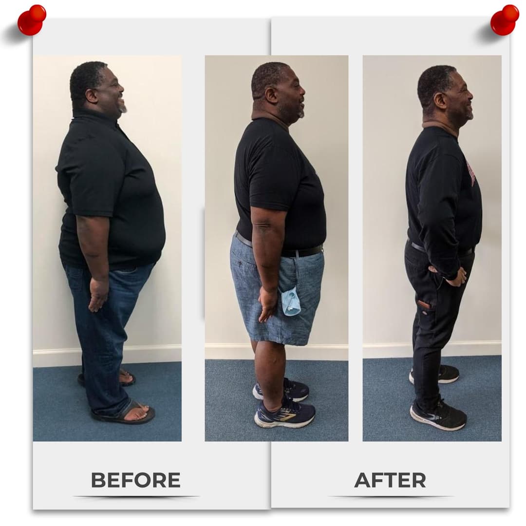 Client before and after 80 lbs and 150 lbs down